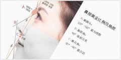 SCH克隆骨鼻综合专家张维娜会怎么对待隆鼻美学设计问题？
